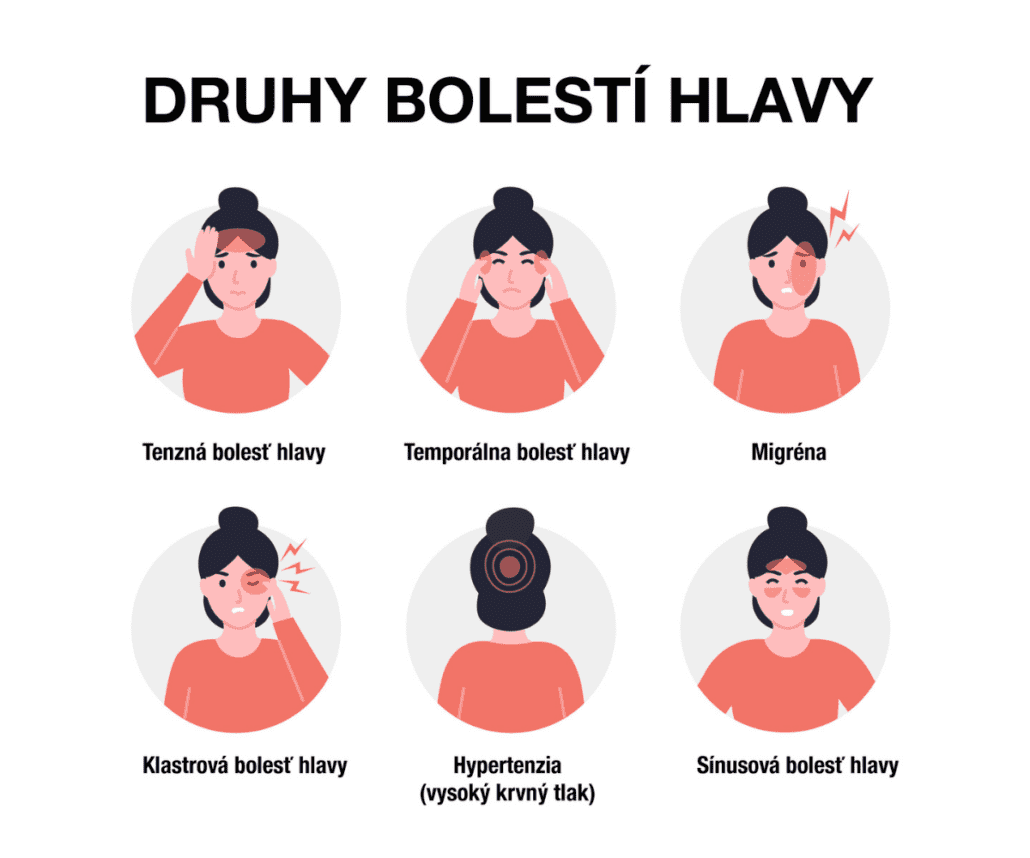 Infografika zobrazujúca jednotlivé druhy bolesti hlavy ako tenzná bolesť, temporálna bolesť, migréna.