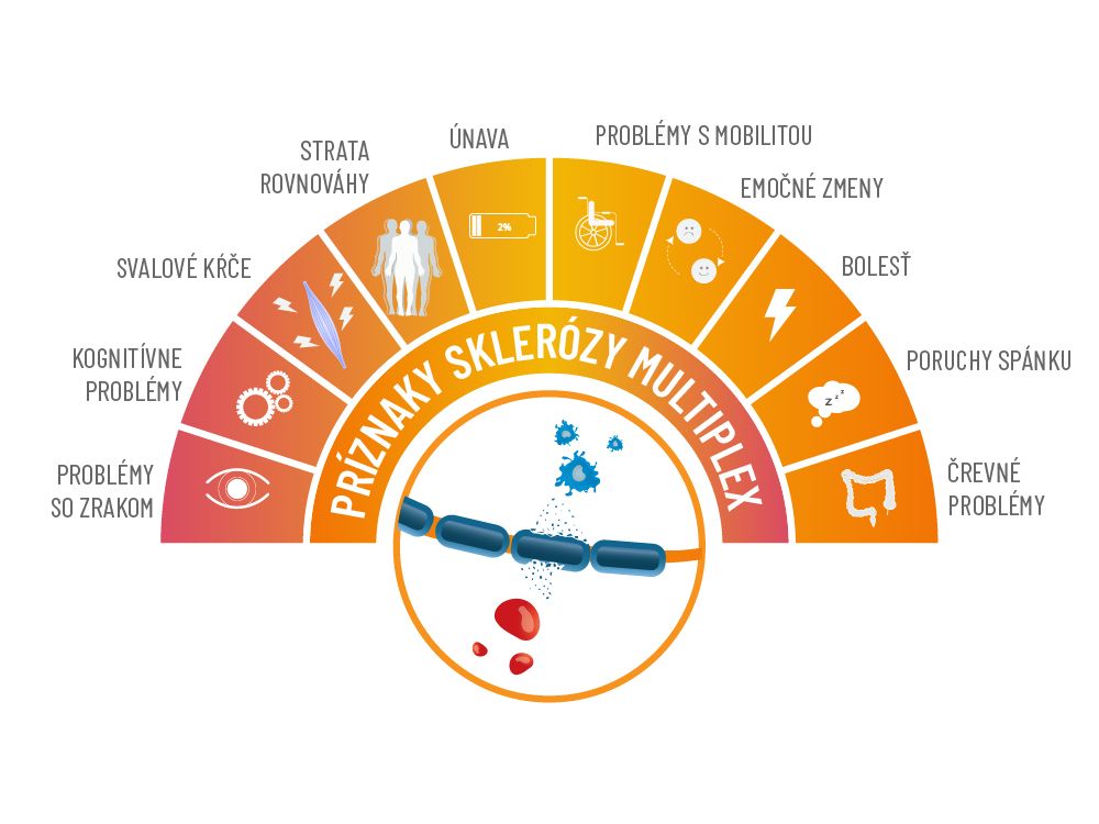 Infografika, ktorá zobrazuje príznaky sklerózy multiplex ako únava, strata rovnováhy, emočné zmeny, poruchy spánku,, problémy so zrakom a pod.