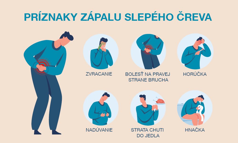 Infografika zobrazuje príznaky zápalu slepého čreva ako je zvracanie, bolesť, nadúvanie, hnačka, strata chuti do jedla.